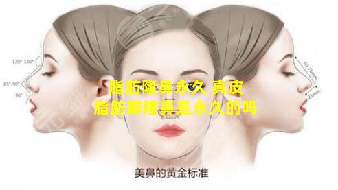 脂肪隆鼻永久 真皮脂肪瓣隆鼻是永久的吗